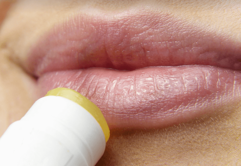 입술 수포? 포다이스반 원인과 증상, 자연 치유 여부